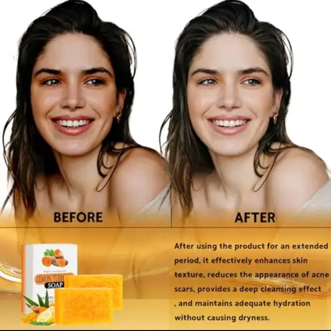 2 barre Savon turmeric à l'acide kojic 100 g